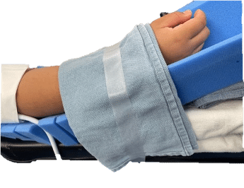 Makeshift 1 (1) A patient's arm elevated with blue foam blocks and towels, secured by a folded cloth and clear tape.