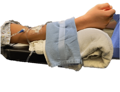 Makeshift 2 (1) A patient's arm with an IV line, propped on a rolled towel and taped down on a surgical arm board.