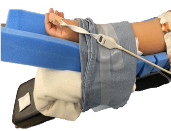 Makeshift 3 (1) A patient's arm on stacked foam and towels, secured with tape, with a medical sensor wired to the hand.