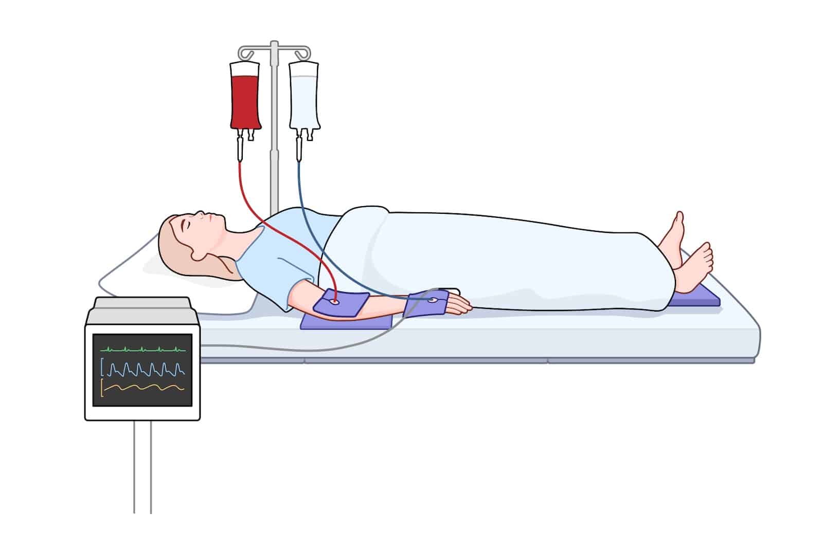 A patient's arm resting in a dark gray foam cradle, secured by a white strap, while in the supine position.
