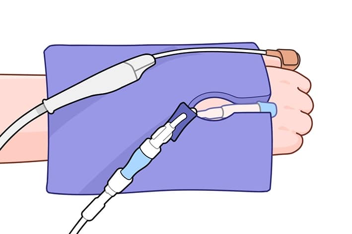 illustration of hand using dermal pad