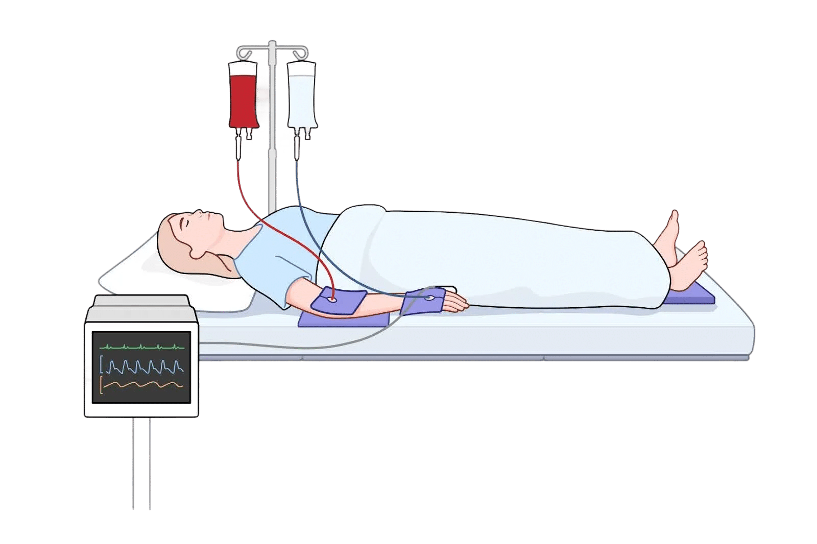 Patient lying on a bed with red and clear IV bags, connected to a blood pressure monitor and devices on both forearms.